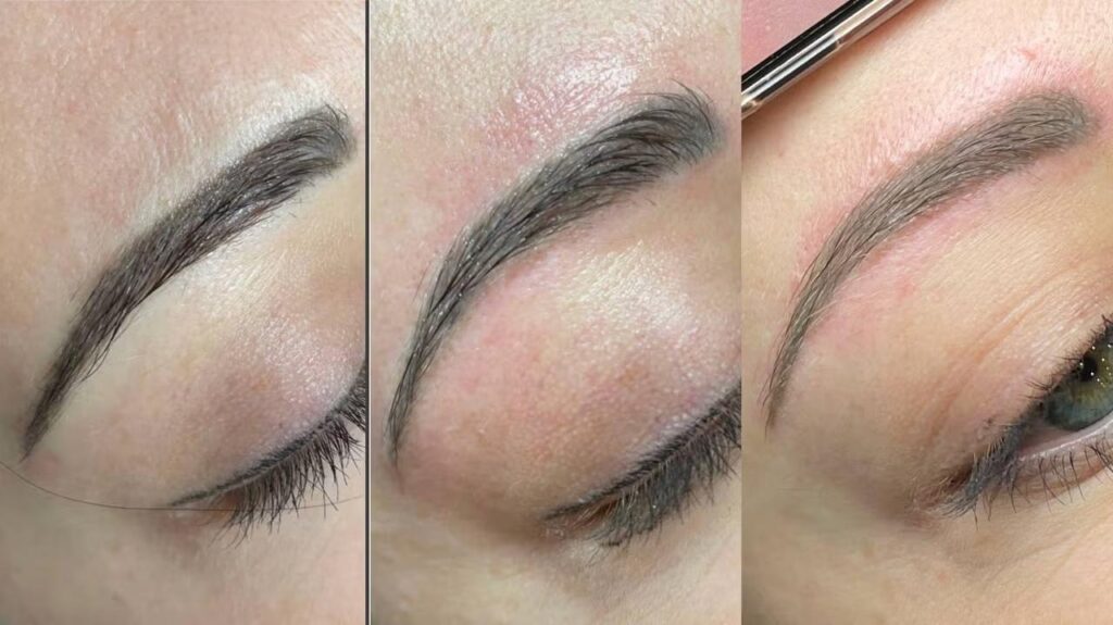 Permanent Makeup Removal | Remover